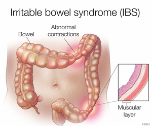 IBS_300x250