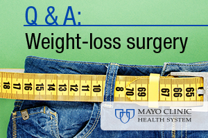 Q Amp A Weight Loss Surgery Mayo Clinic Health System