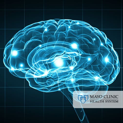 Vagus nerve stimulation: Brain illustration