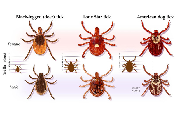 How to and safely remove ticks Mayo Clinic System