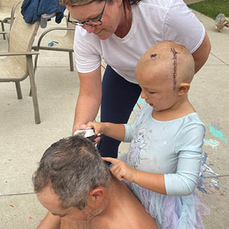 Livia Mayberry with craniotomy scar