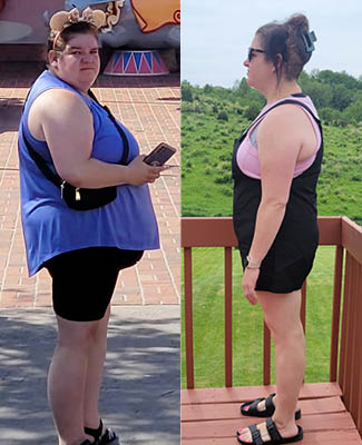 Katie Crow before and after bariatric surgery