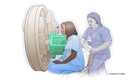 Molecular breast imaging - illustration